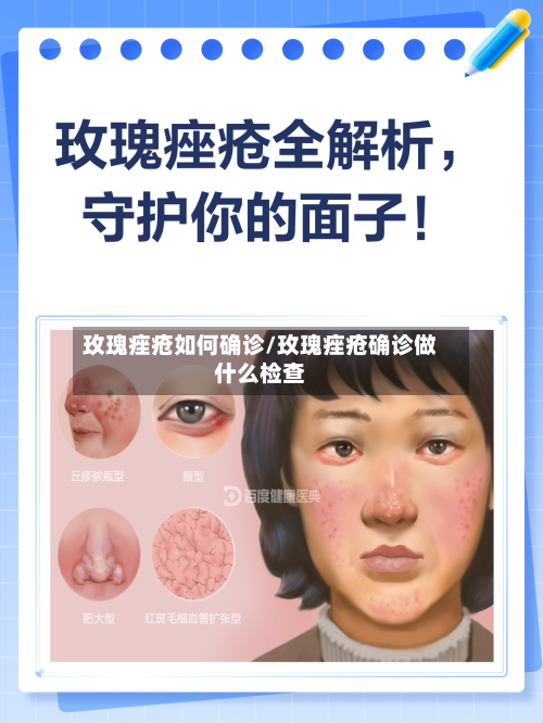 玫瑰痤疮如何确诊/玫瑰痤疮确诊做什么检查-第3张图片