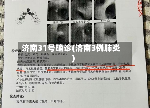 济南31号确诊(济南3例肺炎)