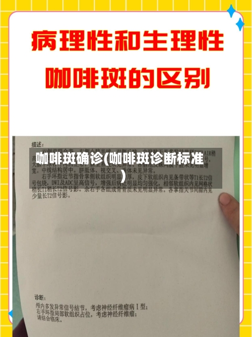 咖啡斑确诊(咖啡斑诊断标准)-第2张图片