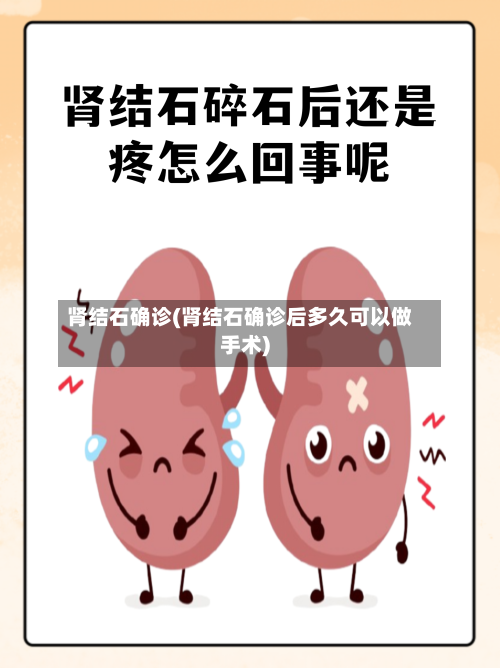 肾结石确诊(肾结石确诊后多久可以做手术)
