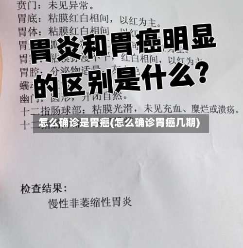 怎么确诊是胃癌(怎么确诊胃癌几期)-第2张图片