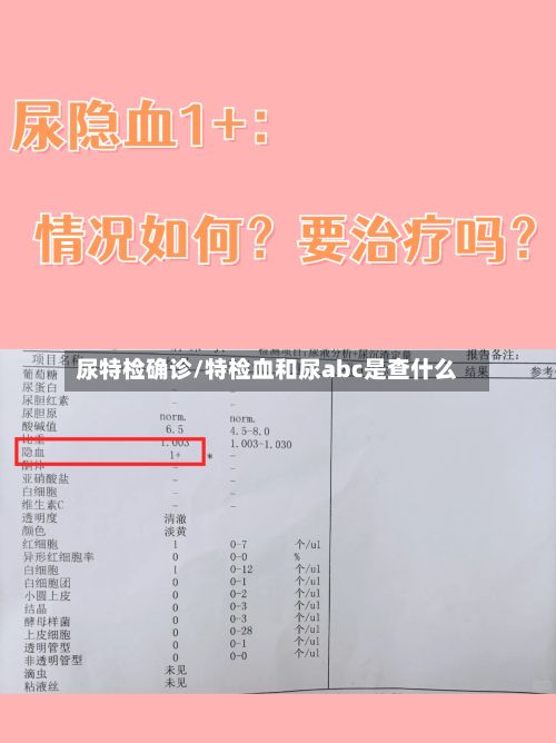 尿特检确诊/特检血和尿abc是查什么-第2张图片
