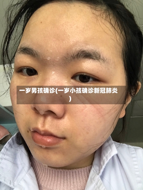 一岁男孩确诊(一岁小孩确诊新冠肺炎)-第3张图片