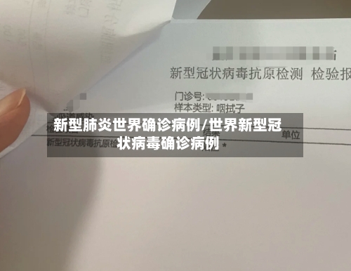新型肺炎世界确诊病例/世界新型冠状病毒确诊病例-第2张图片
