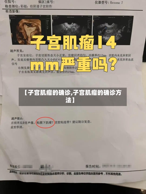 【子宫肌瘤的确诊,子宫肌瘤的确诊方法】
