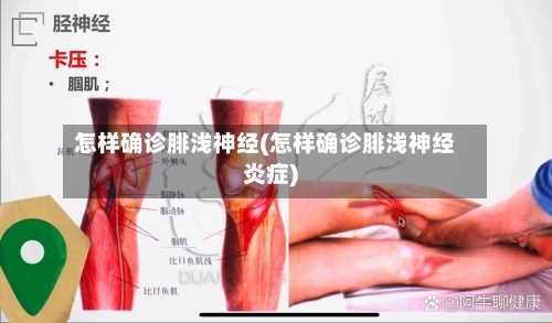 怎样确诊腓浅神经(怎样确诊腓浅神经炎症)-第1张图片