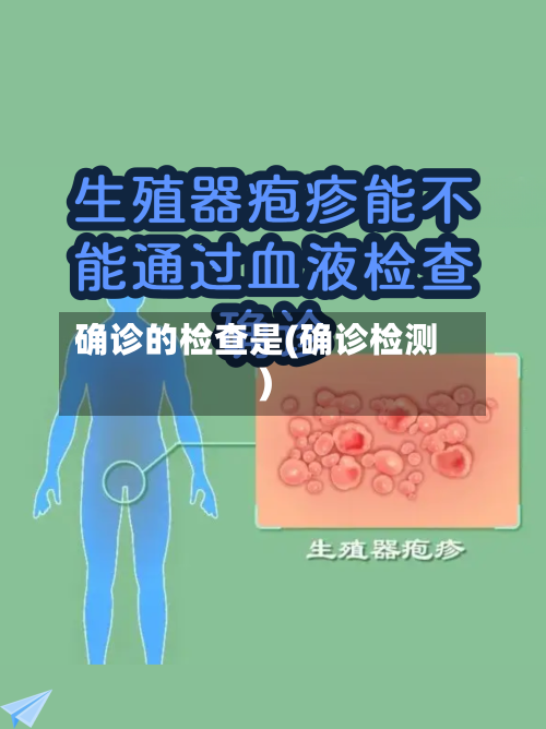 确诊的检查是(确诊检测)-第1张图片