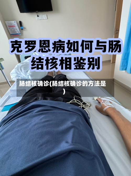 肠结核确诊(肠结核确诊的方法是)-第2张图片