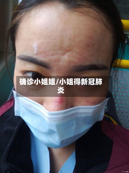 确诊小姐姐/小姐得新冠肺炎-第2张图片
