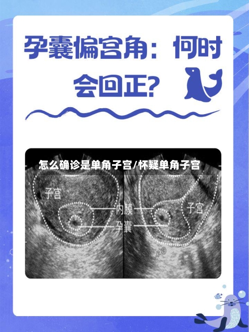 怎么确诊是单角子宫/怀疑单角子宫-第2张图片