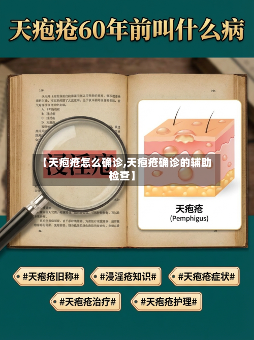 【天疱疮怎么确诊,天疱疮确诊的辅助检查】
