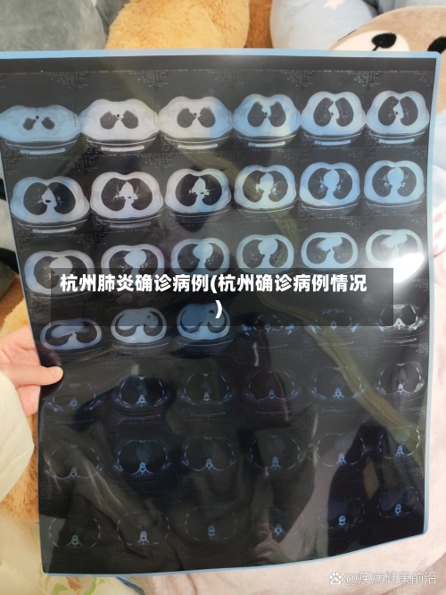 杭州肺炎确诊病例(杭州确诊病例情况)-第2张图片