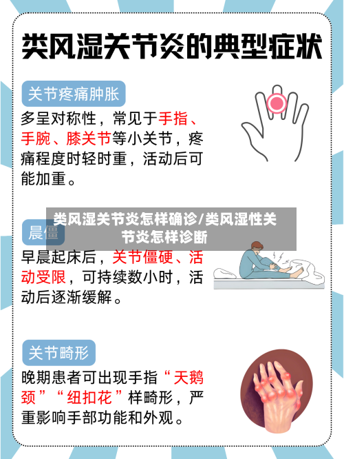 类风湿关节炎怎样确诊/类风湿性关节炎怎样诊断