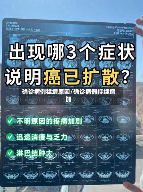确诊病例猛增原因/确诊病例持续增加-第2张图片