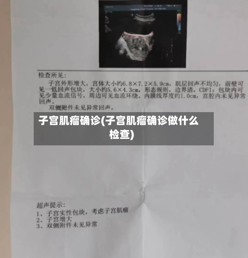 子宫肌瘤确诊(子宫肌瘤确诊做什么检查)-第2张图片