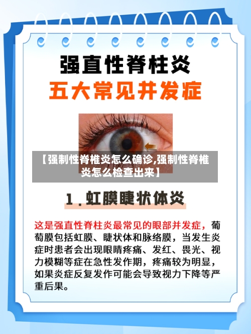 【强制性脊椎炎怎么确诊,强制性脊椎炎怎么检查出来】