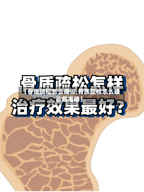 【骨质疏松怎么确诊,骨质疏松怎么确诊最准确】