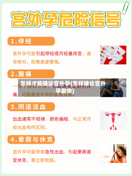怎样才能确诊宫外孕(怎样确诊宫外孕最快)-第2张图片