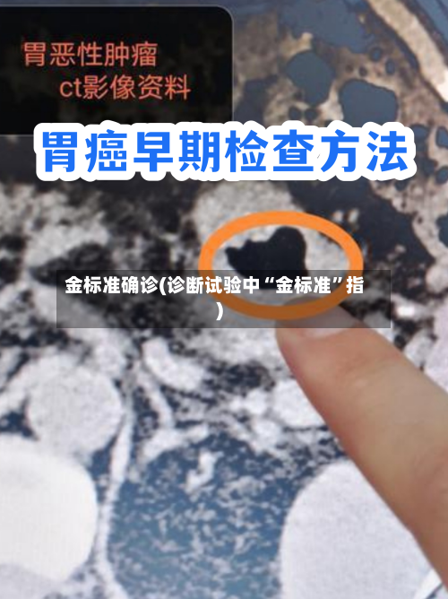 金标准确诊(诊断试验中“金标准”指)-第2张图片