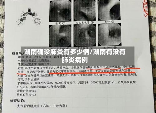 湖南确诊肺炎有多少例/湖南有没有肺炎病例
