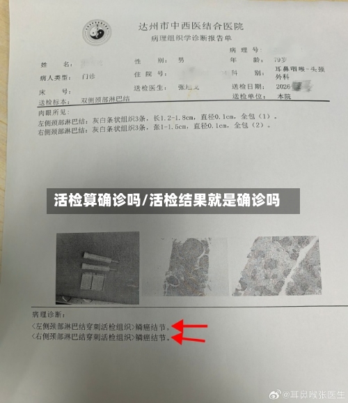 活检算确诊吗/活检结果就是确诊吗