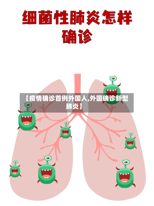 【疫情确诊首例外国人,外国确诊新型肺炎】-第2张图片