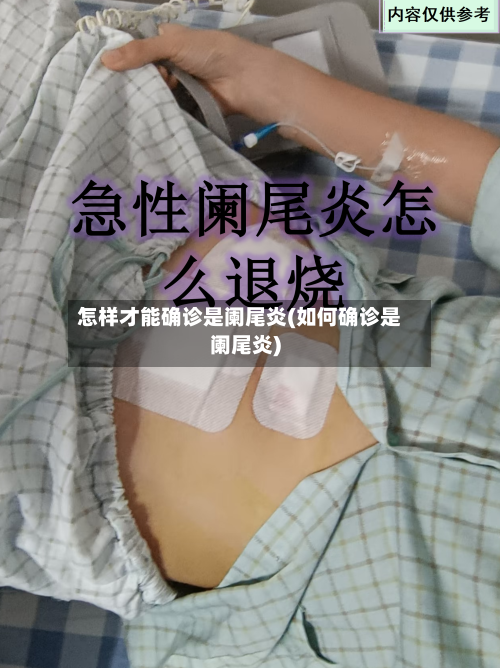 怎样才能确诊是阑尾炎(如何确诊是阑尾炎)