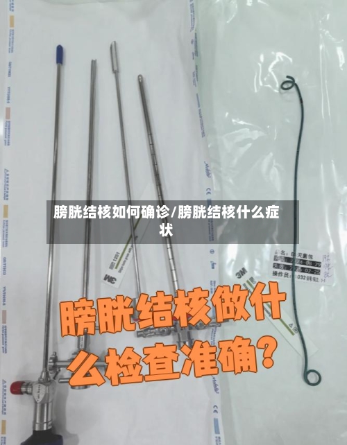 膀胱结核如何确诊/膀胱结核什么症状