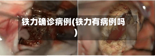 铁力确诊病例(铁力有病例吗)