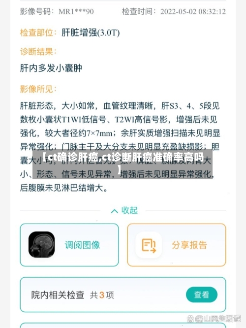 【ct确诊肝癌,ct诊断肝癌准确率高吗】-第2张图片