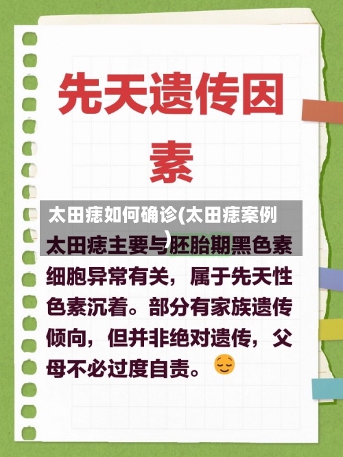 太田痣如何确诊(太田痣案例)