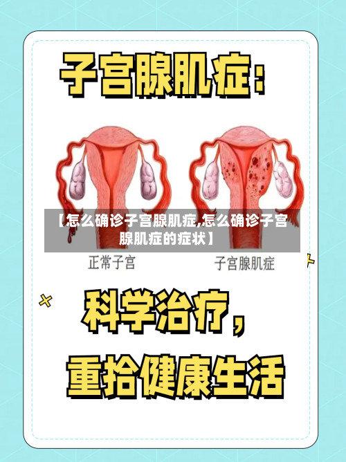 【怎么确诊子宫腺肌症,怎么确诊子宫腺肌症的症状】-第2张图片