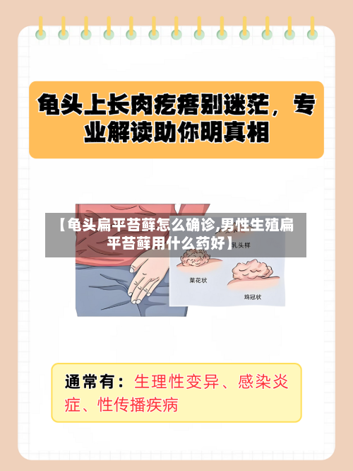 【龟头扁平苔藓怎么确诊,男性生殖扁平苔藓用什么药好】-第2张图片
