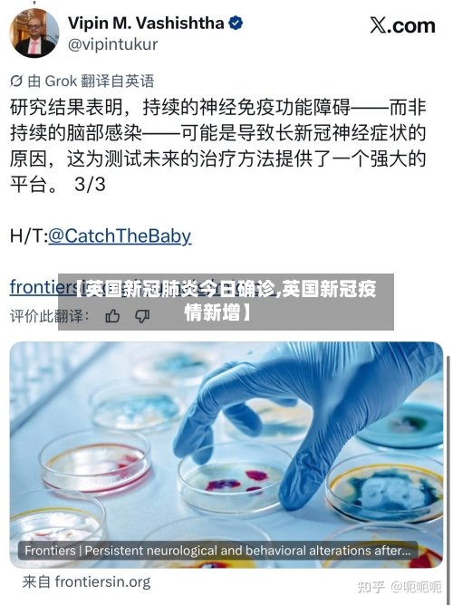 【英国新冠肺炎今日确诊,英国新冠疫情新增】-第2张图片