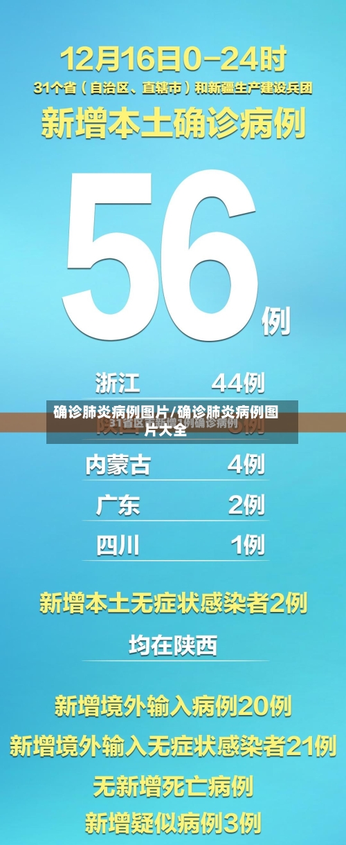 确诊肺炎病例图片/确诊肺炎病例图片大全