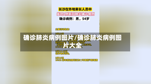 确诊肺炎病例图片/确诊肺炎病例图片大全-第3张图片