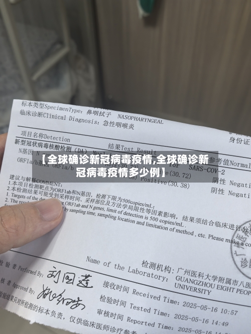 【全球确诊新冠病毒疫情,全球确诊新冠病毒疫情多少例】-第2张图片