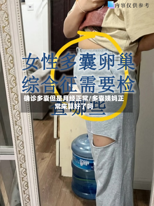 确诊多囊但是月经正常/多囊姨妈正常来算好了吗