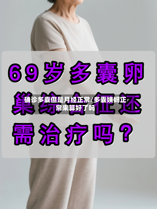 确诊多囊但是月经正常/多囊姨妈正常来算好了吗-第2张图片