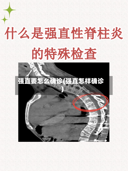 强直要怎么确诊(强直怎样确诊)