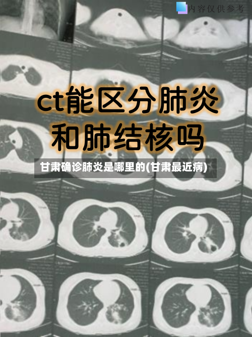 甘肃确诊肺炎是哪里的(甘肃最近病)