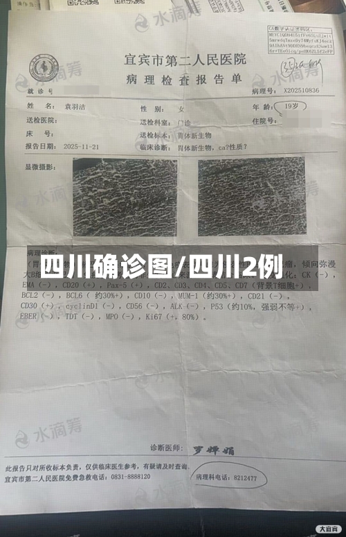 四川确诊图/四川2例-第3张图片