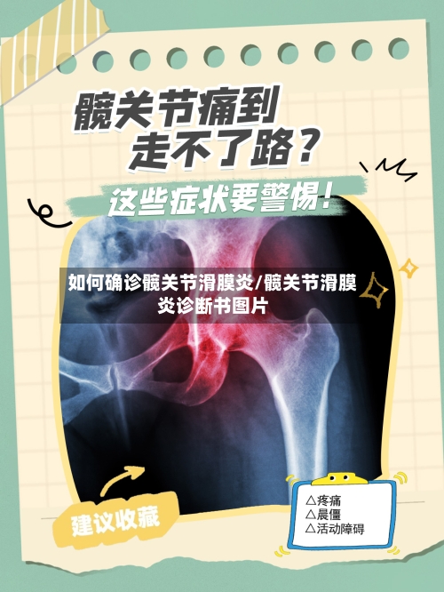 如何确诊髋关节滑膜炎/髋关节滑膜炎诊断书图片
